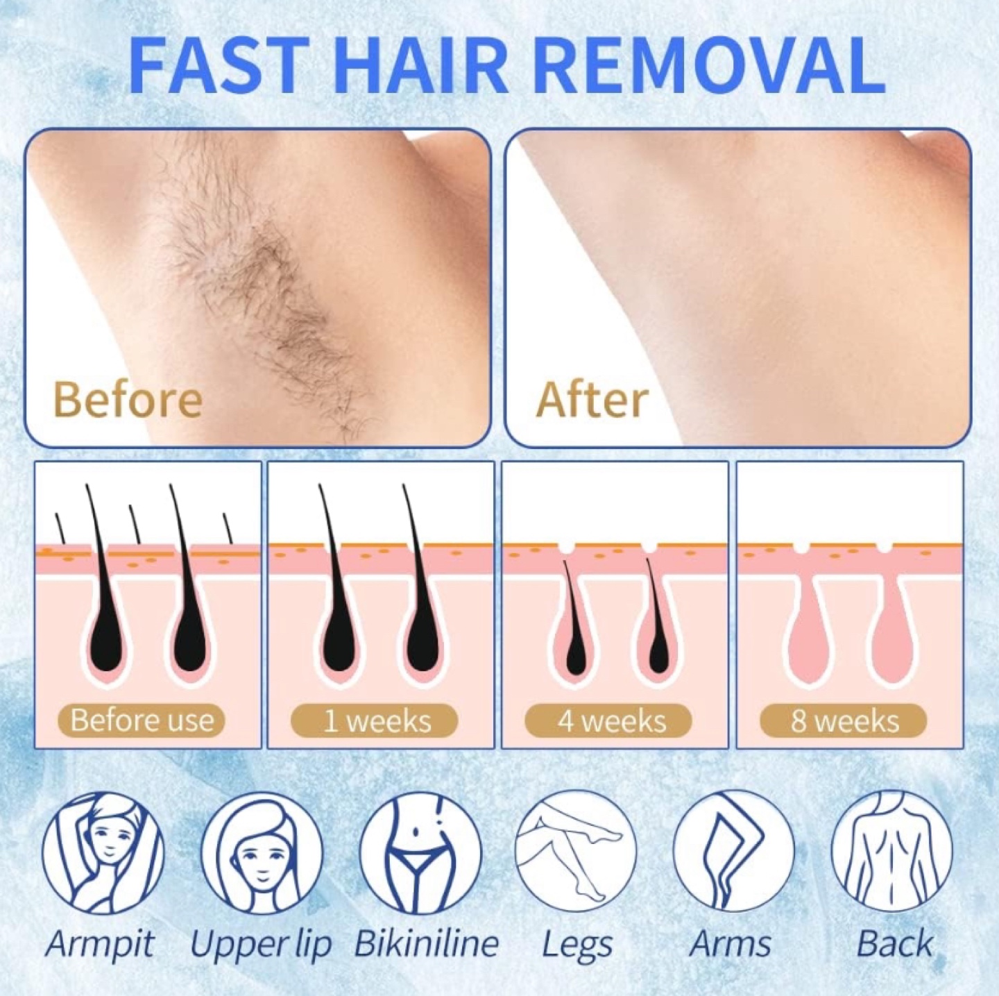 Ice-Compress Hair Removal Device brand new