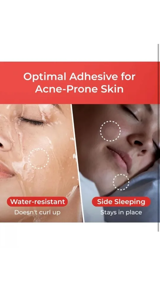 SOSKY Invisible+ Pimple Patches - 48 Count image indicator(4)