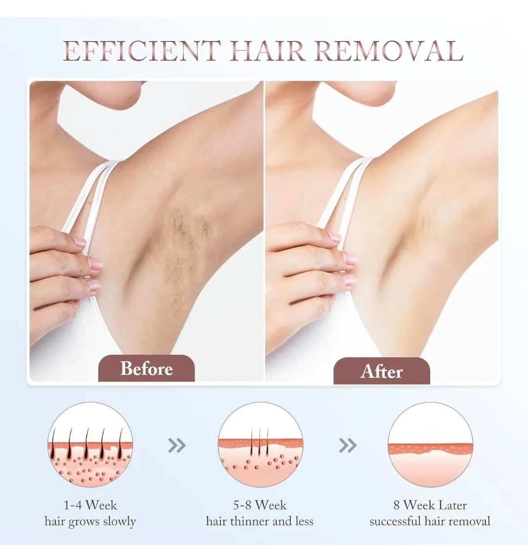 IPL Hair Removal Device - 5 Energy Levels, 3 Treatment Heads image indicator(5)