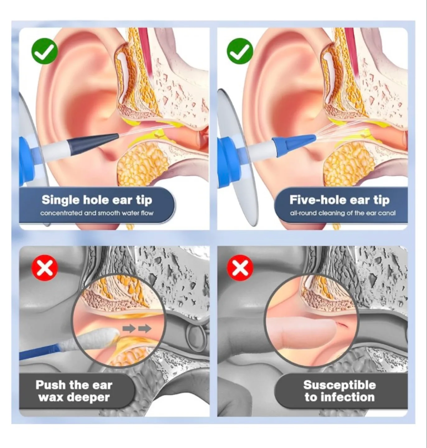 Kaugic Electric Ear Cleaner with Irrigation System image indicator(6)