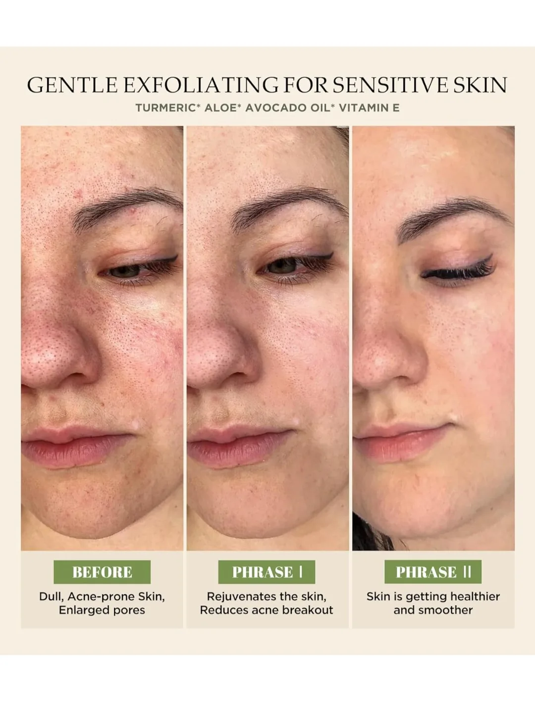 Exfoliation Face Scrub with Vitamin C Turmeric Face Wash image indicator(4)