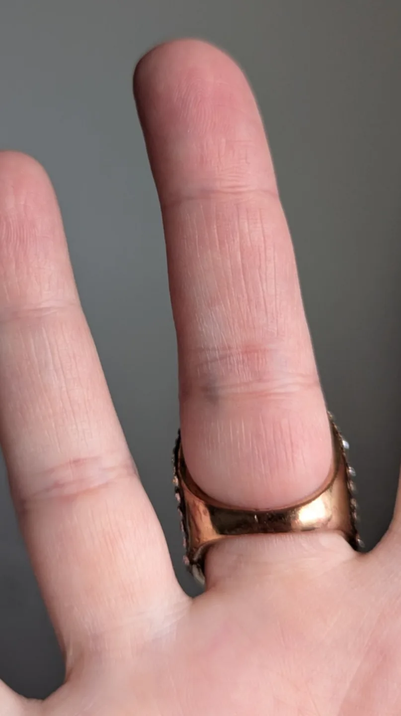 Visson statement ring image indicator(3)