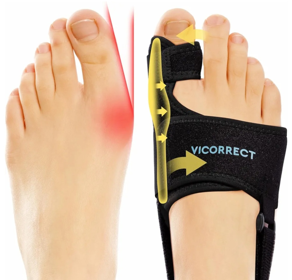Pair of black bunion correctors.