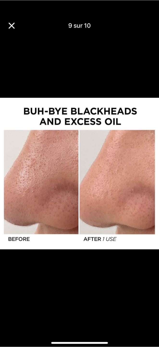 BeautyBio GloFacial Concentrate Device - photo 2
