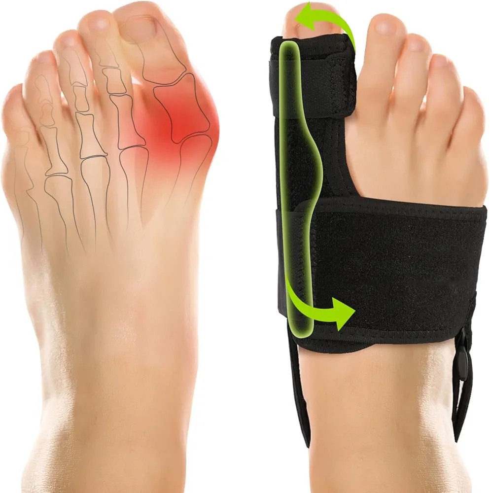 Bunion Auxiliary correction kit