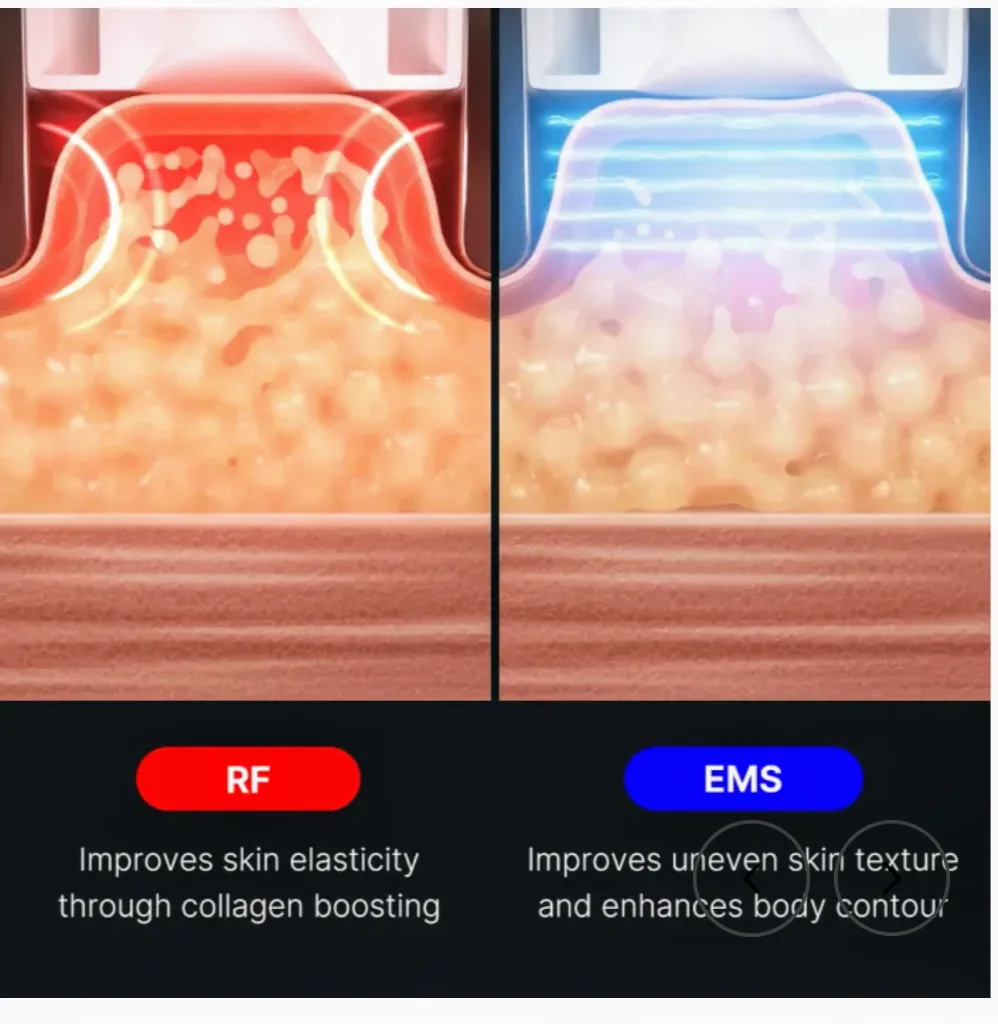 MedicuBE RF & EMS Body Contouring Device image indicator(6)