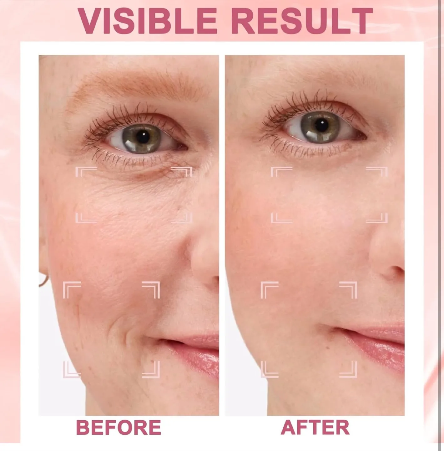 Beauty Instrument image indicator(5)