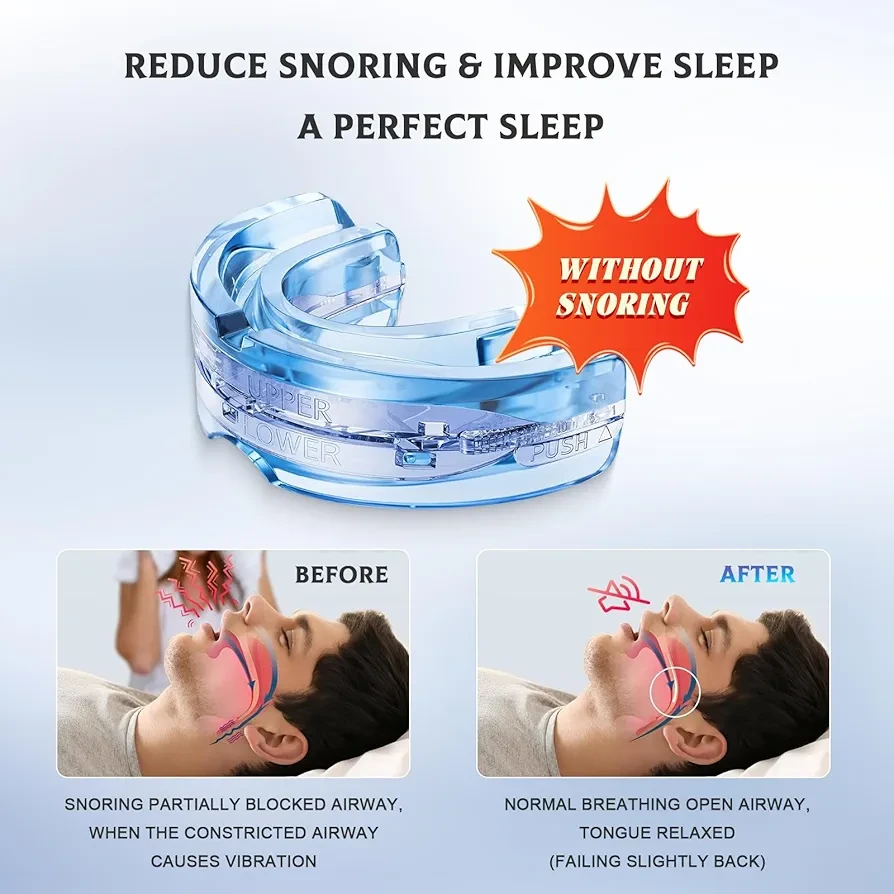 NEW Anti-Snoring Mouthpiece - Snore Solution Expert - photo 4