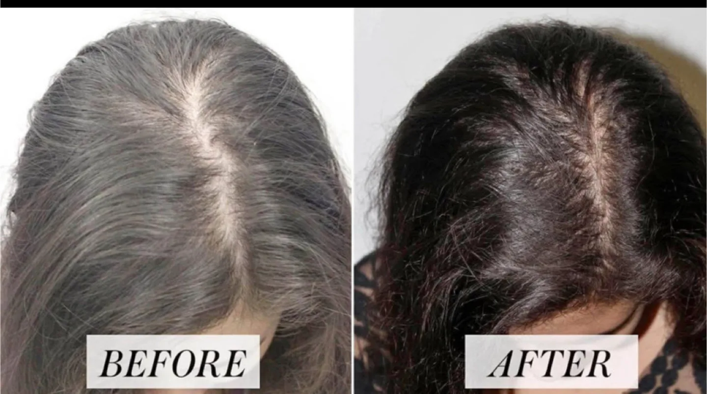 ✅ Healthy Hair ✅ Hair Loose Solution thumbnail