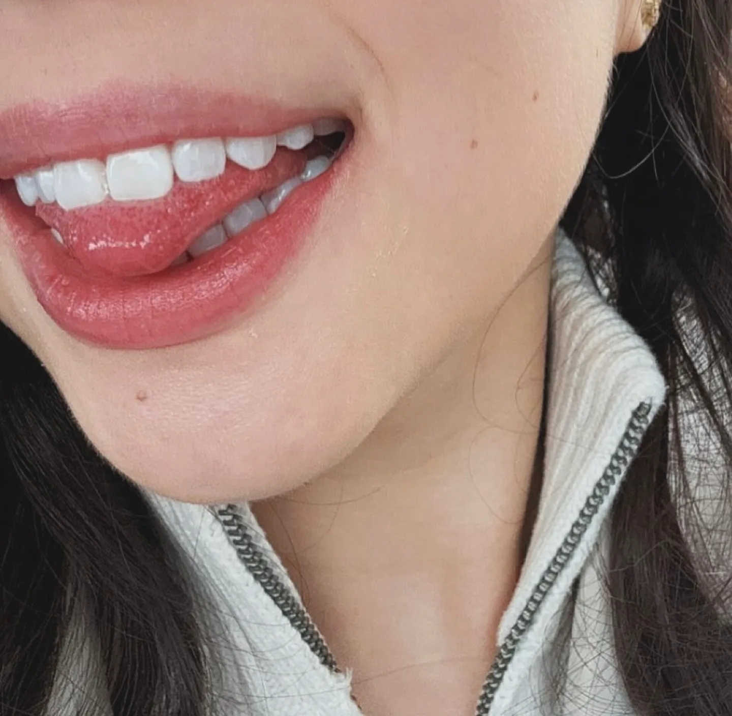 In Office Teeth Whitening thumbnail
