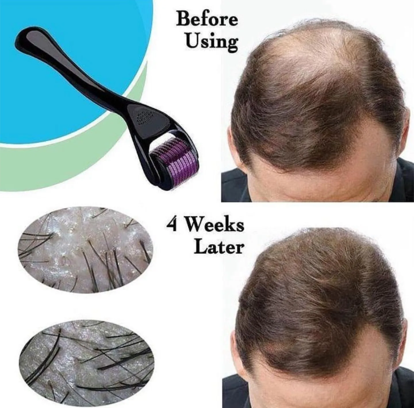 BRAND NEW DERM ROLLER thumbnail