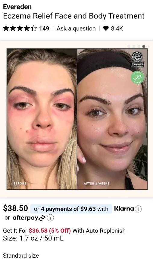 Eczema Relief Cream image indicator(2)