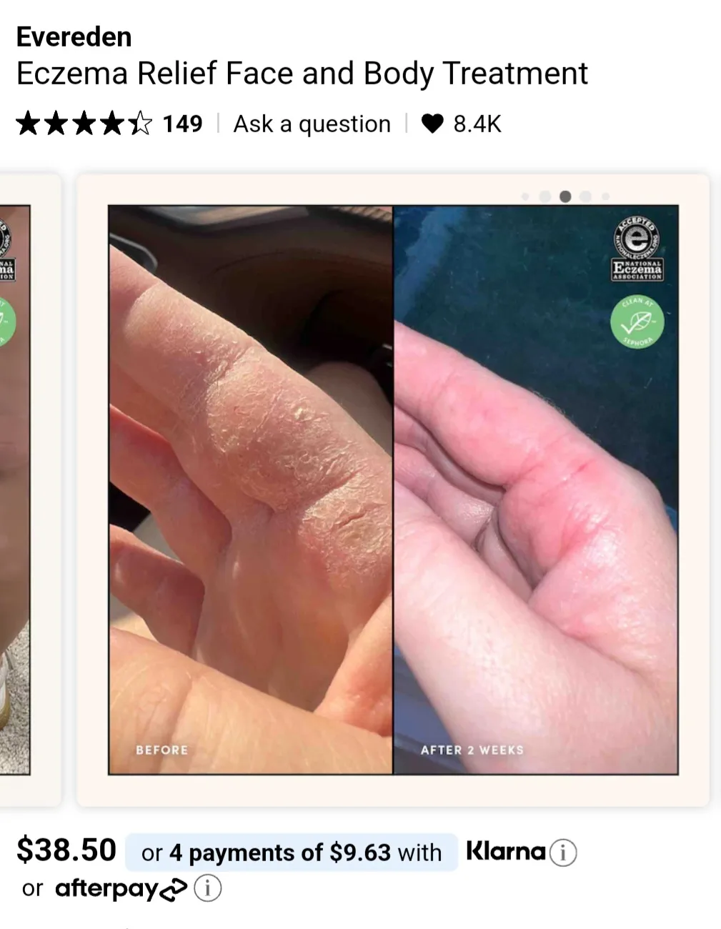 Eczema Relief Cream image indicator(4)