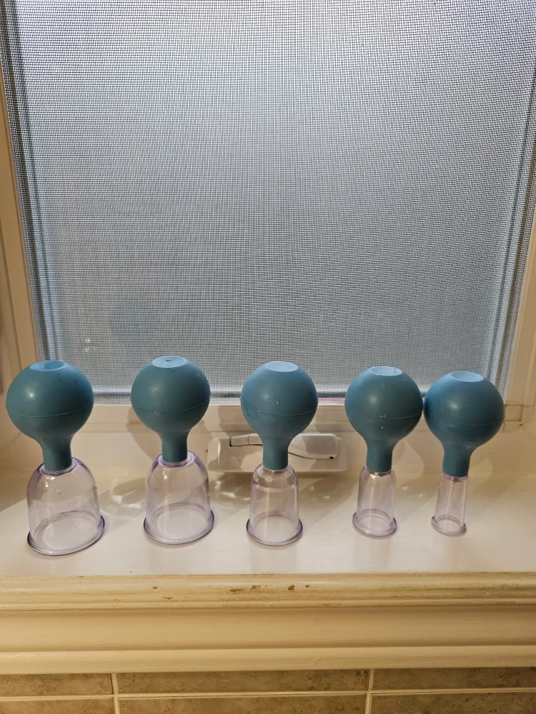 Set of 5 Cupping Therapy Cups thumbnail