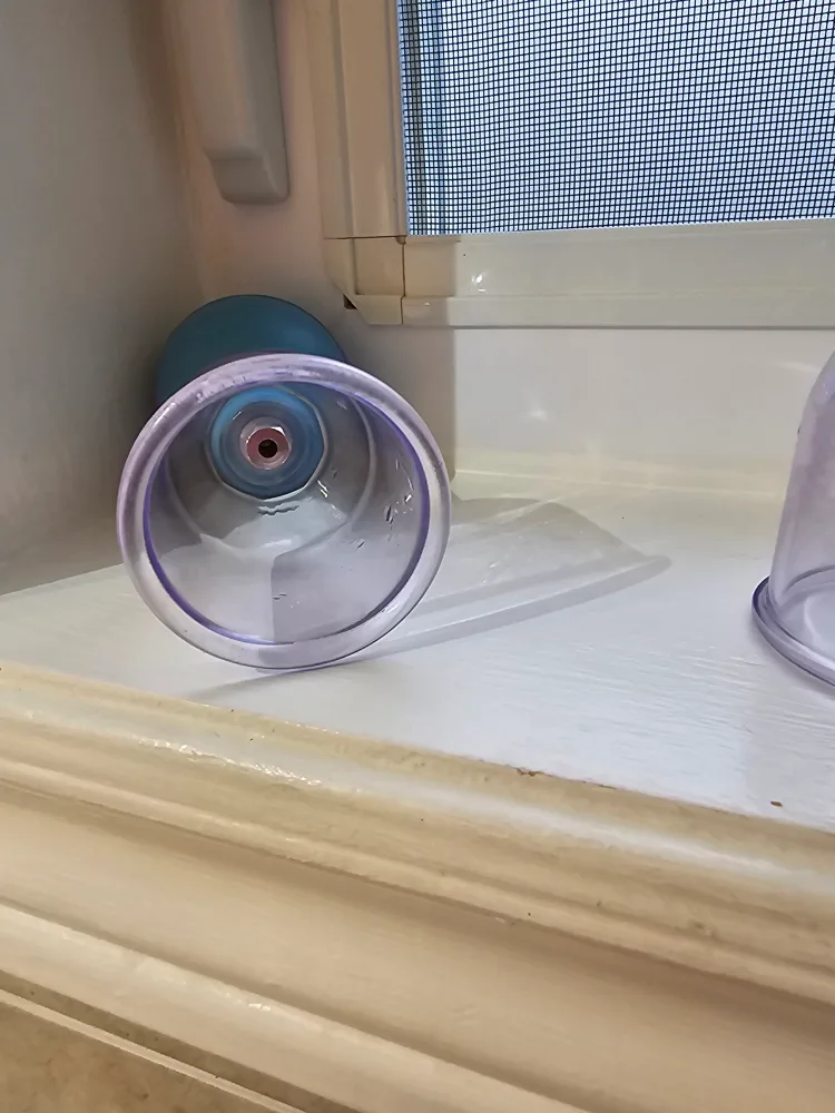 Set of 5 Cupping Therapy Cups image indicator(2)