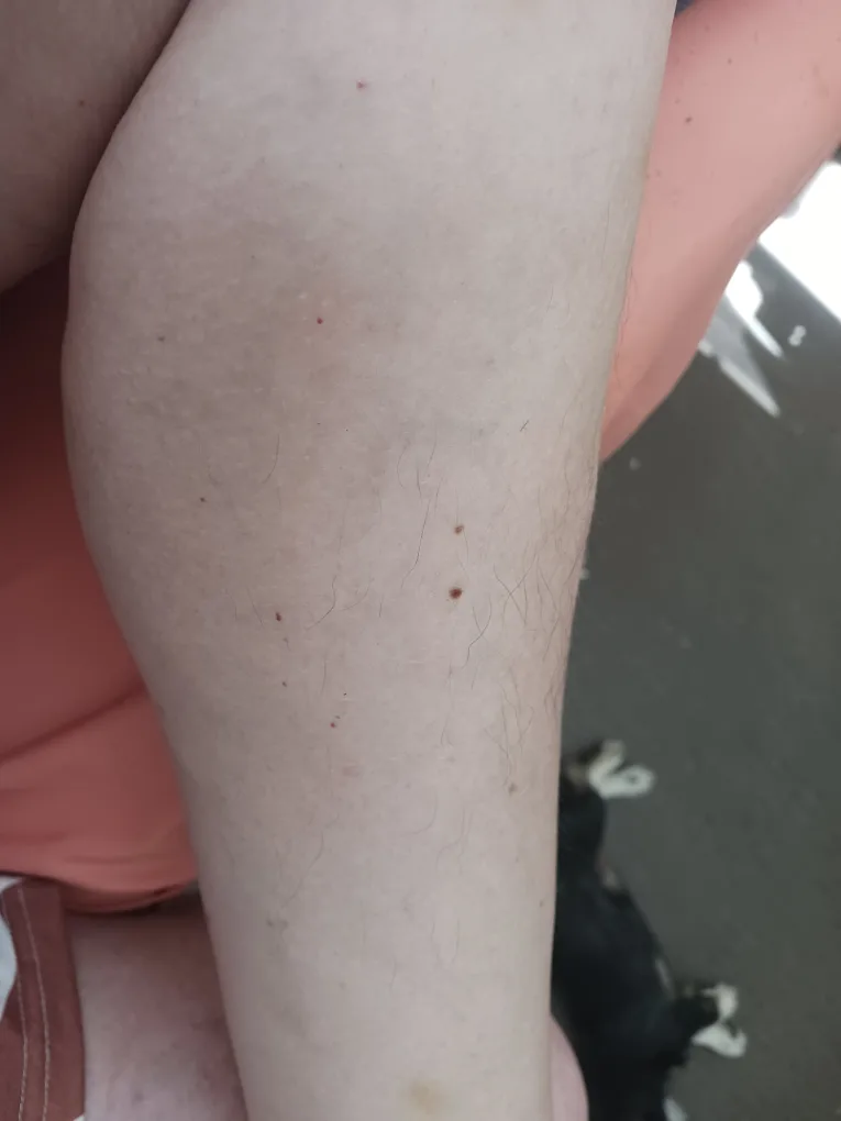 Lux Skin IPL Hair Removal Device image indicator(4)