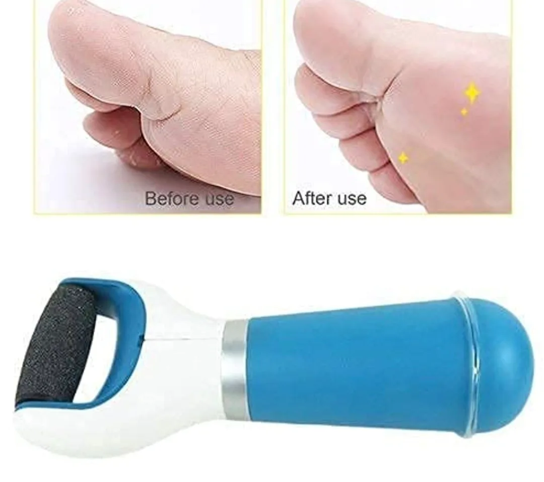 Personal pedi Foot Care Callus Remover image indicator(5)