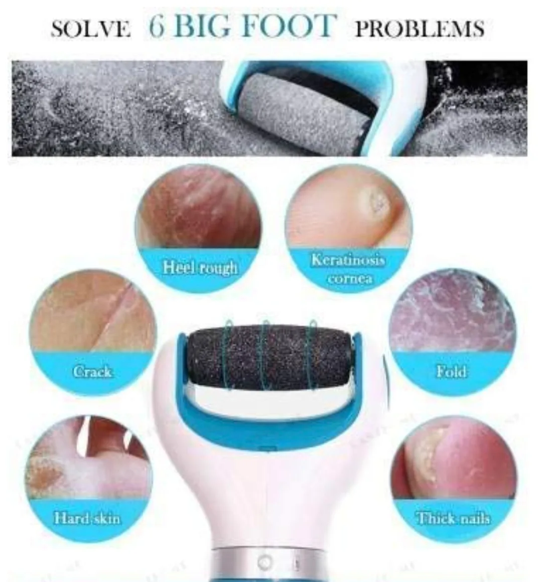 Personal pedi Foot Care Callus Remover image indicator(7)