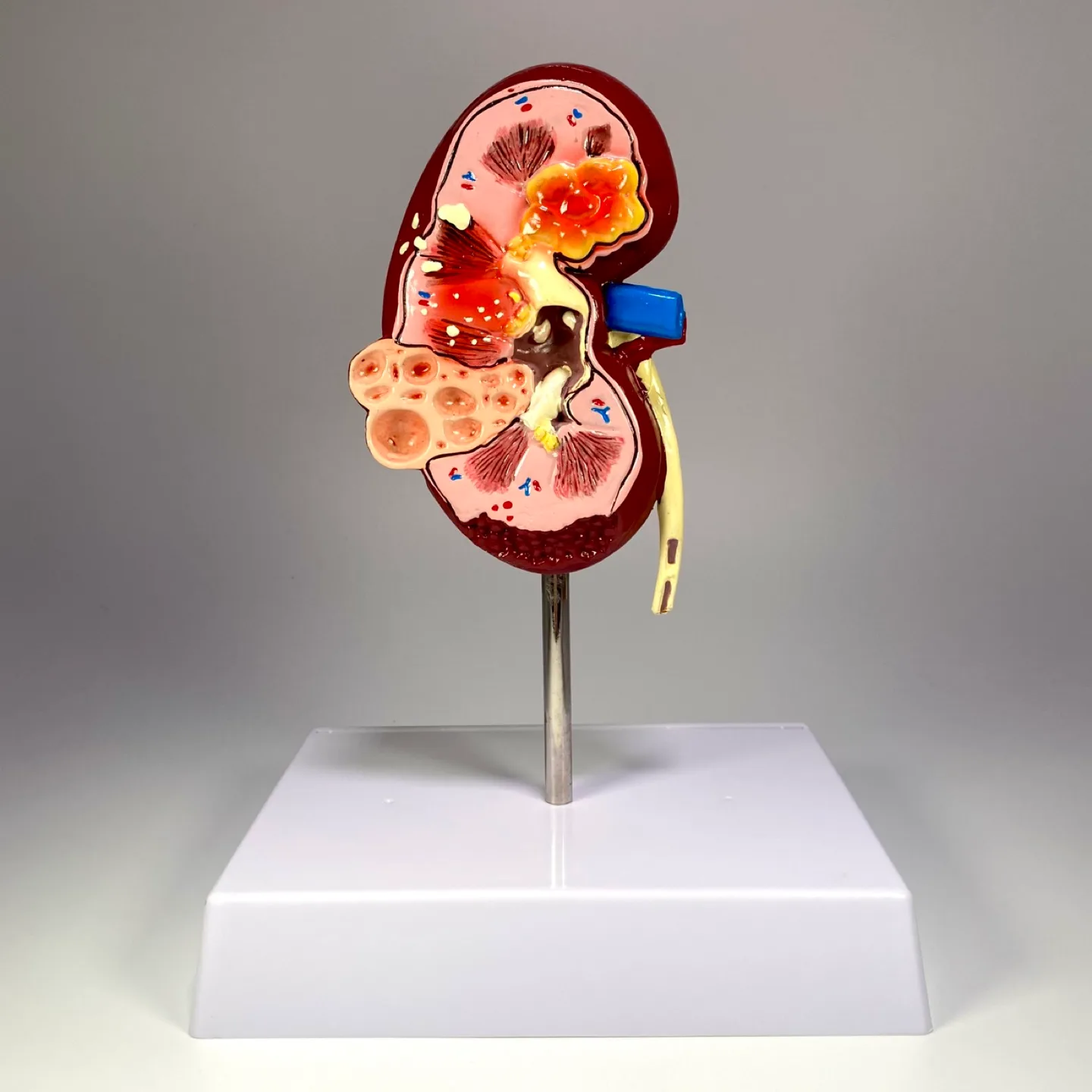 Anatomical Kidney Model thumbnail