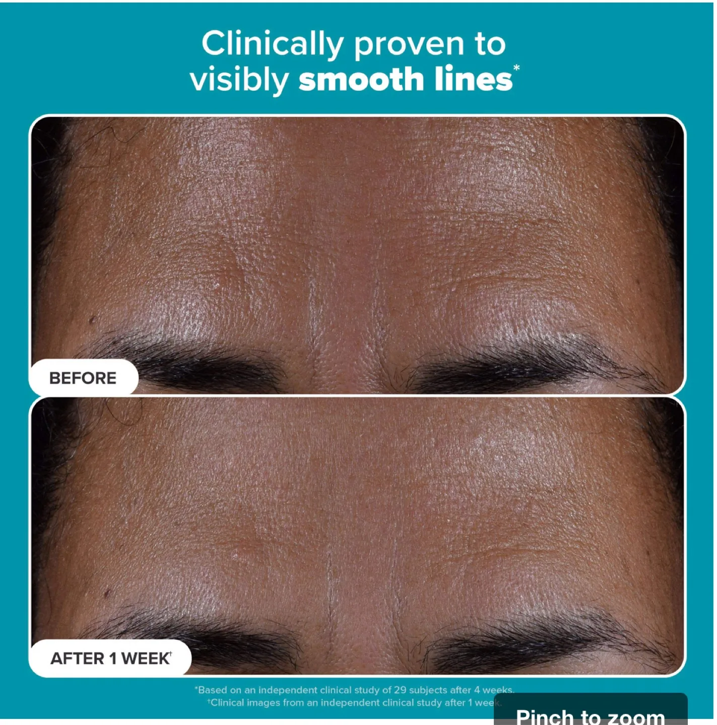 Paula's Choice 2% BHA Liquid Exfoliant image indicator(5)