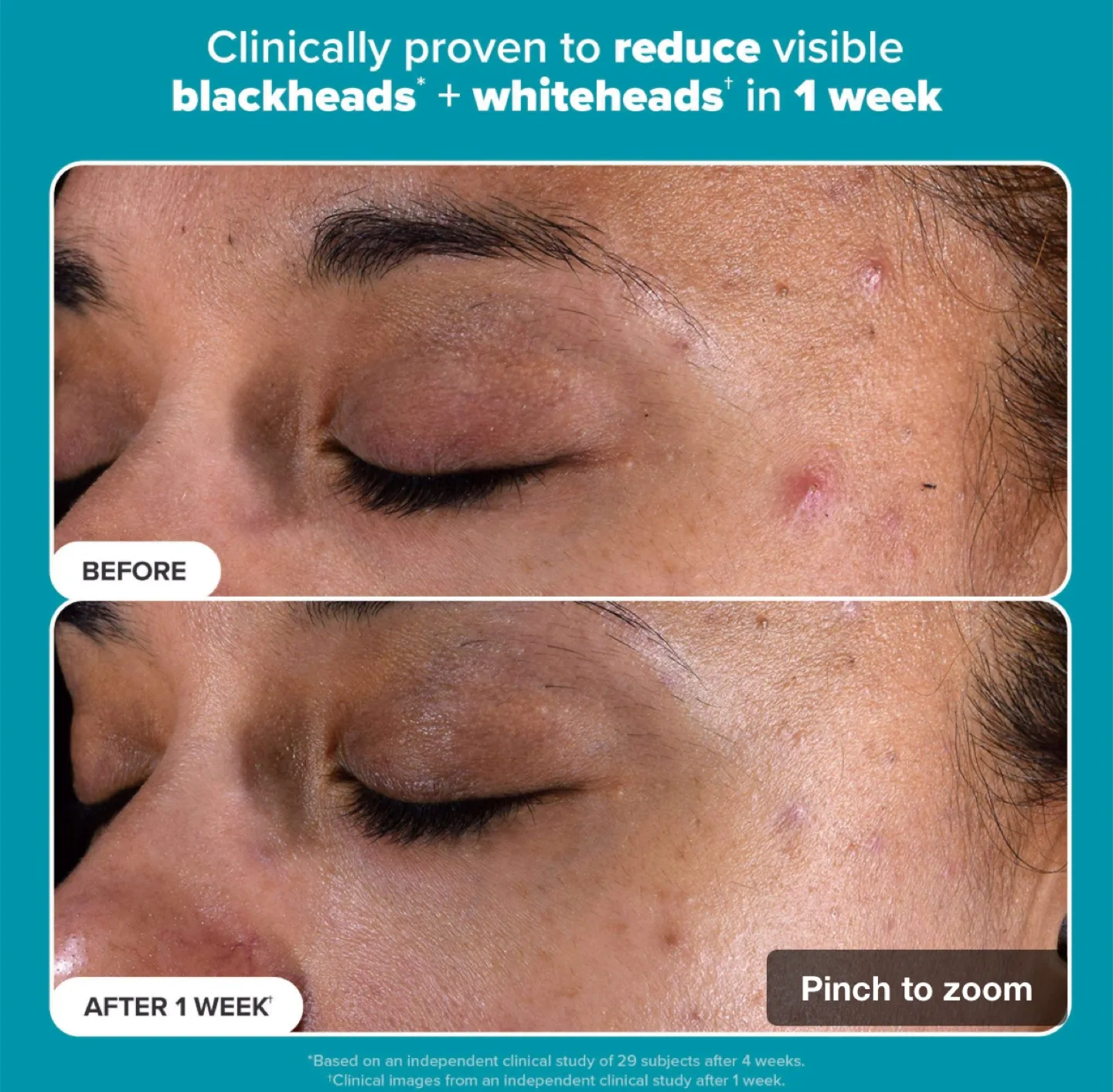 Paula's Choice 2% BHA Liquid Exfoliant image indicator(6)