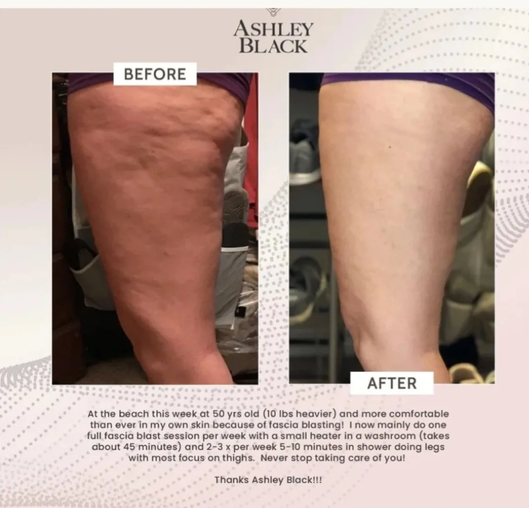 FasciaBlaster Original Bar & Nugget Cellulite by Ashley Black image indicator(2)