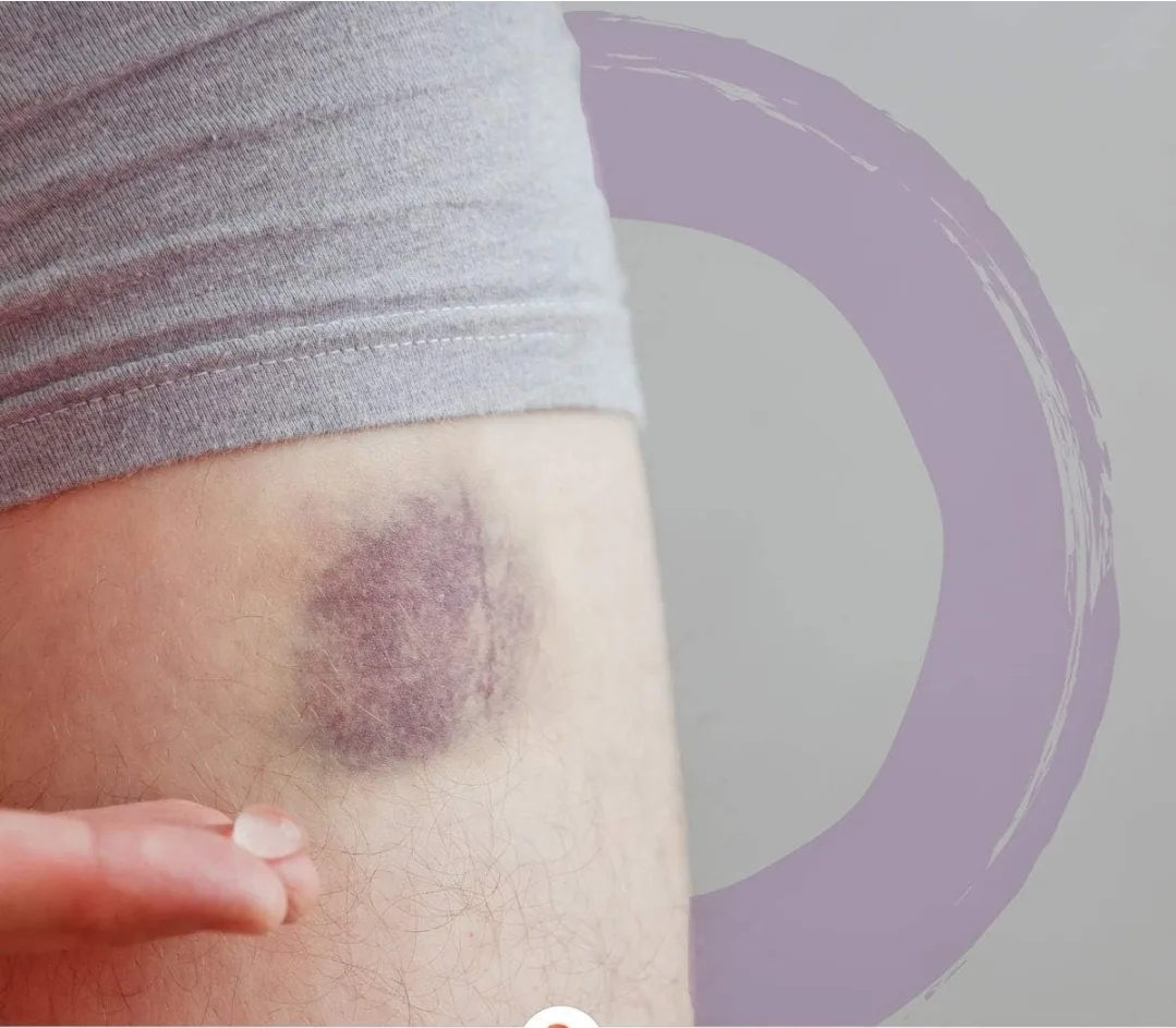 Boiron Arnicare Bruise Gel 45g – Natural Soothing Relief image indicator(8)