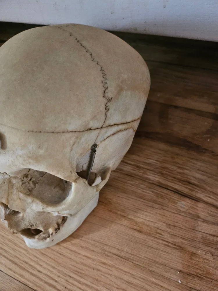 ANTIQUE MEDICAL SKULL image indicator(2)