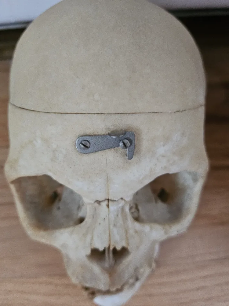 ANTIQUE MEDICAL SKULL image indicator(3)