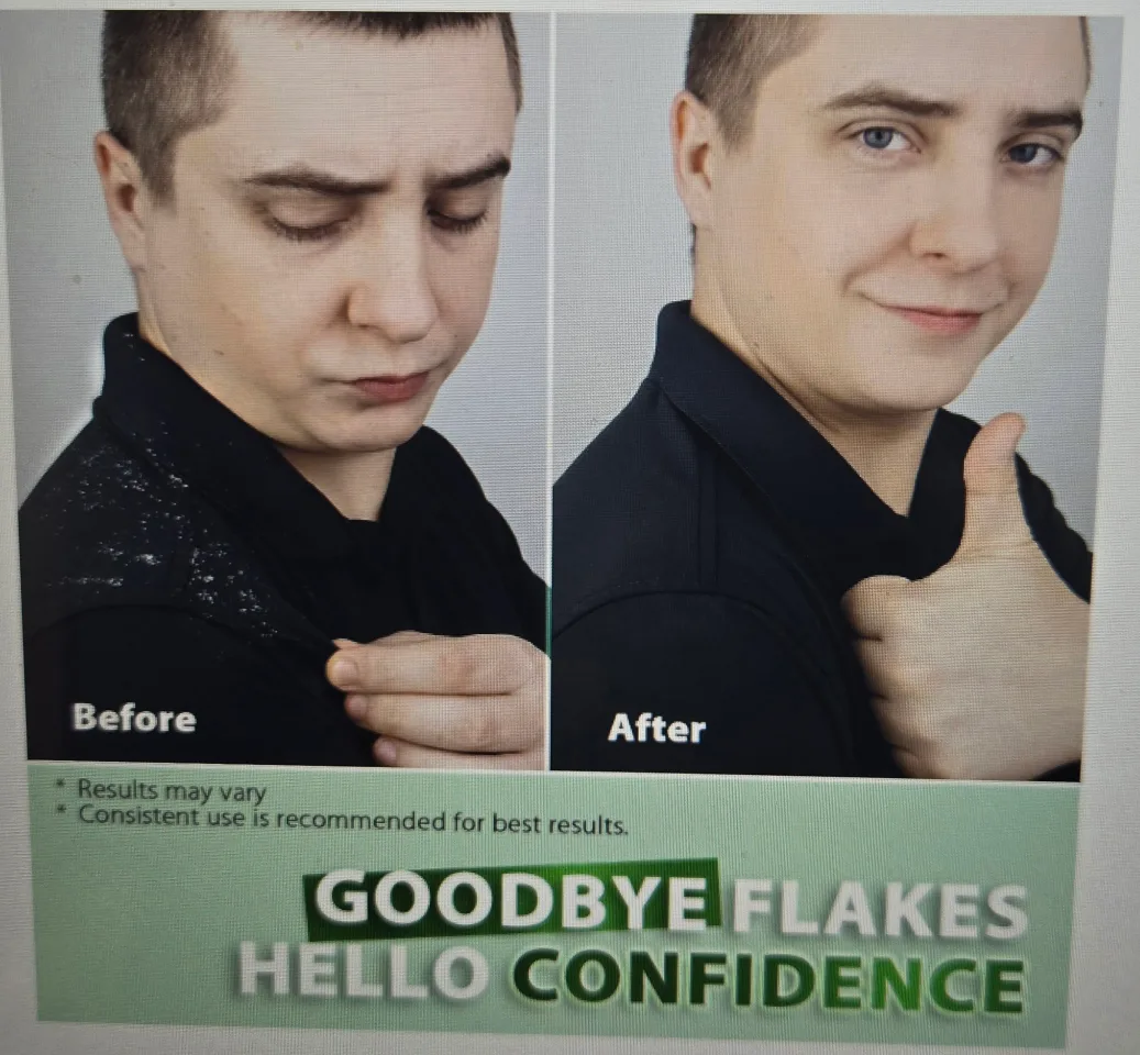 Scalp Shampoo image indicator(8)