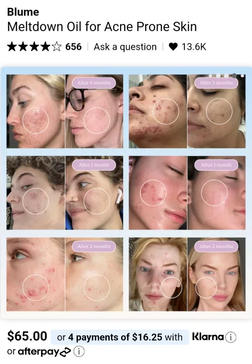 Blume Acne Prone Skin Oil image indicator(2)