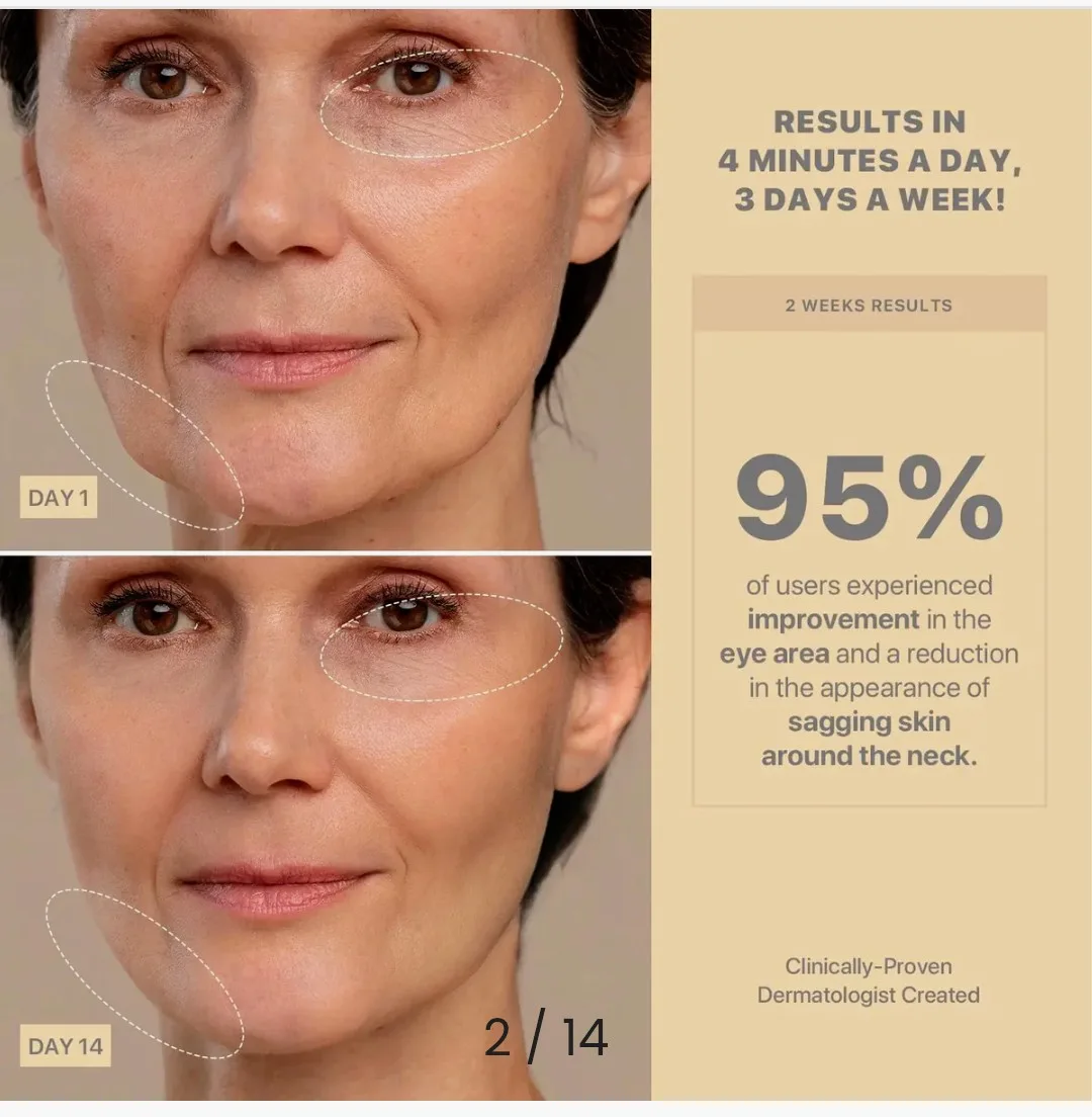 AMIRO R3 Turbo Facial RF Skin Tightening Device image indicator(3)