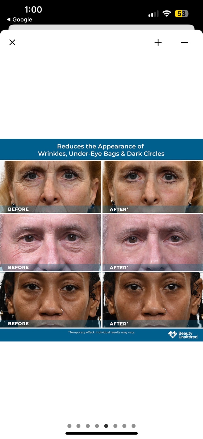Plexaderm Rapid Reduction Serum - photo 4