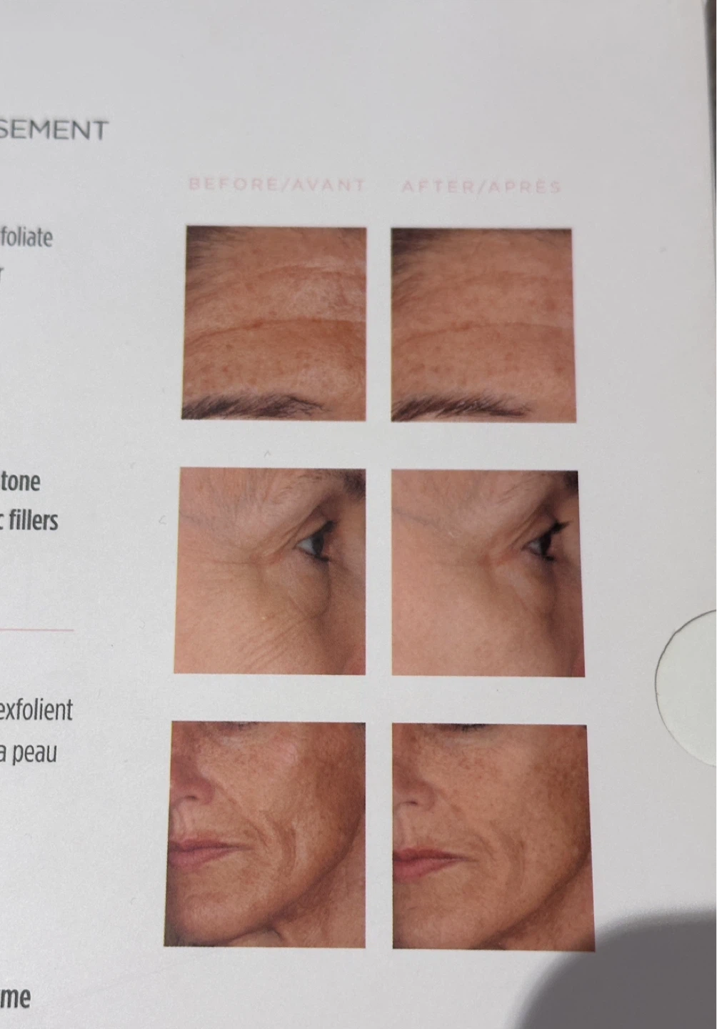 GloPRO Microneedling Rejuvenation Tool Set - photo 4