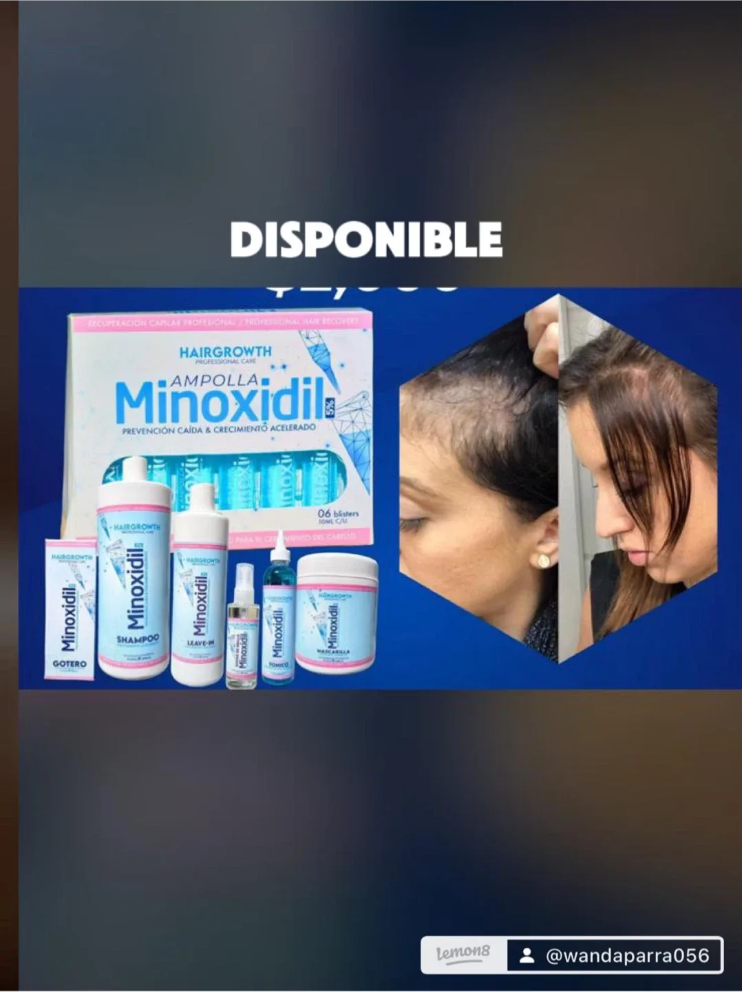 Hairgrowth Minoxidil 5% Set image indicator(2)