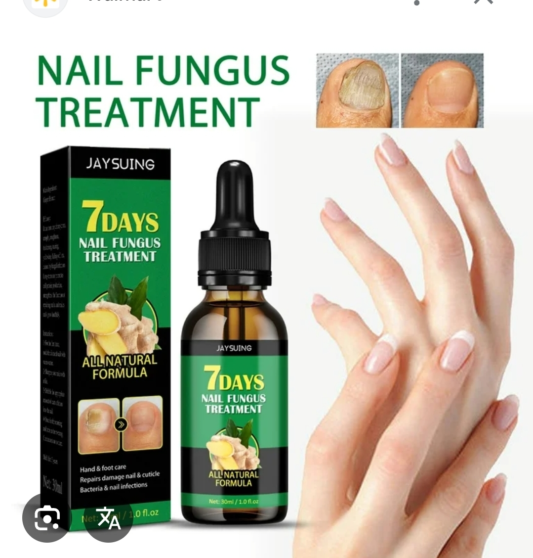 Jaysuing 7 Days Nail Fungus Treatment