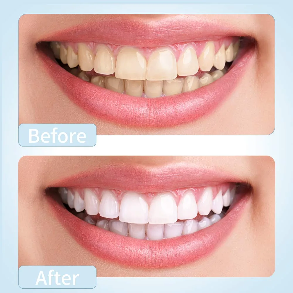 KHH Water Flosser Pick Teeth Cleaner Dental image indicator(6)