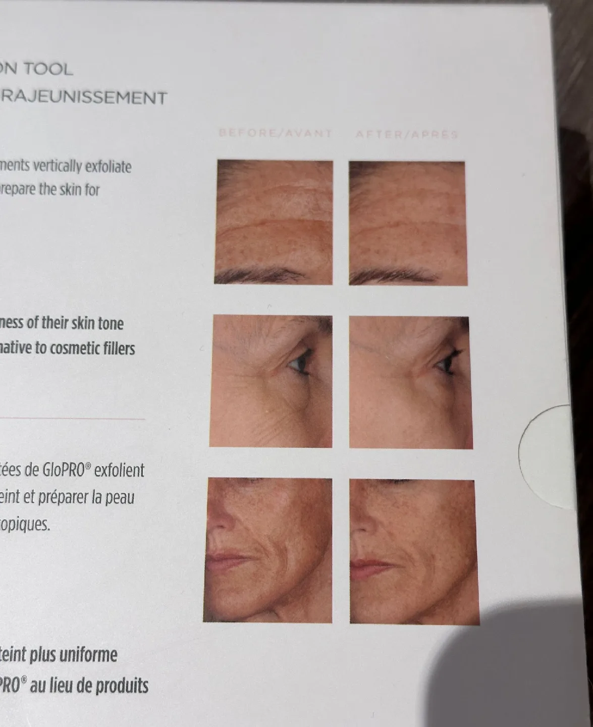 GloPRO MicroNeedling Rejuvenation Tool image indicator(4)