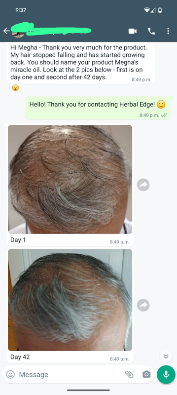 Hair preconditioning treatment for hair loss, thinning - photo 4
