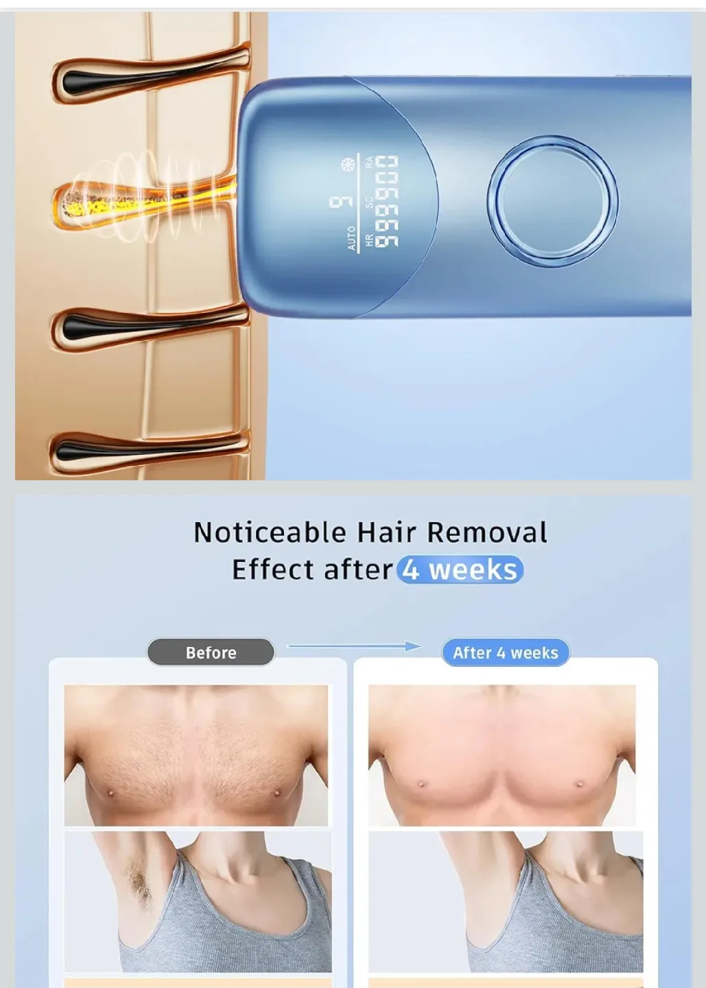 ICE-COOL Hand-held IPL Hair Removal Device - New! image indicator(4)