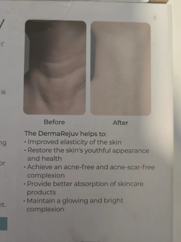 DermaRejuv LED Micro-Current Massager image indicator(4)