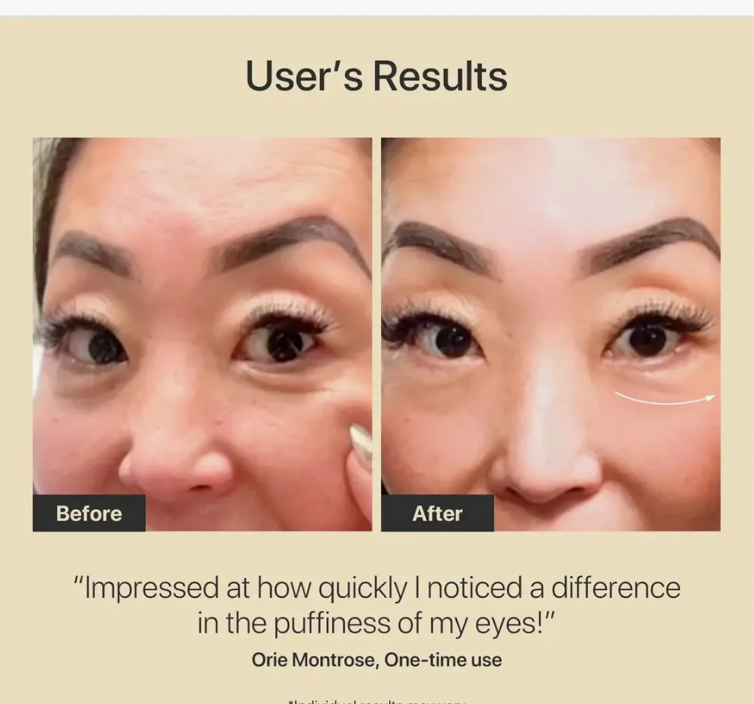 AMIRO R3 Turbo Facial RF Skin Tightening Device image indicator(4)