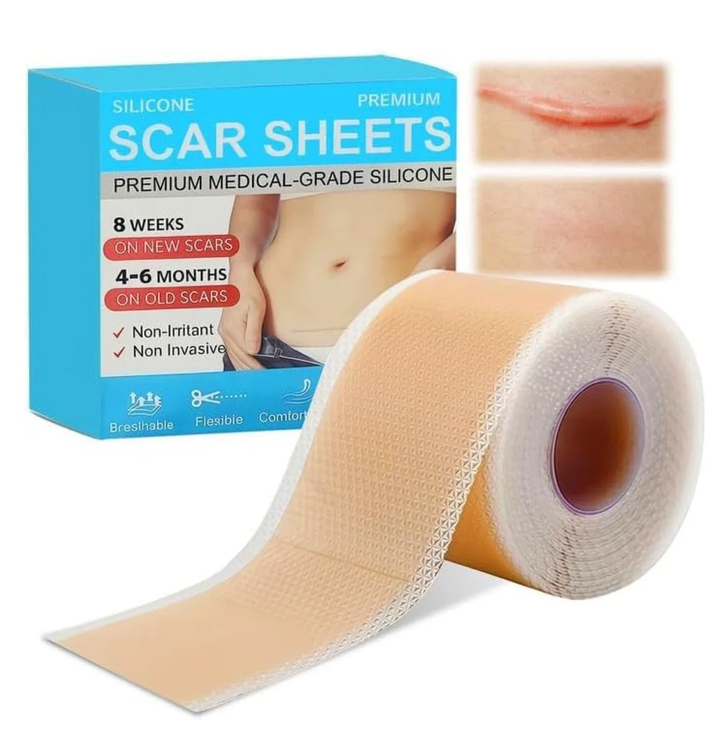 *SEALED* Silicone Scar Sheets - 150cm x 4cm thumbnail