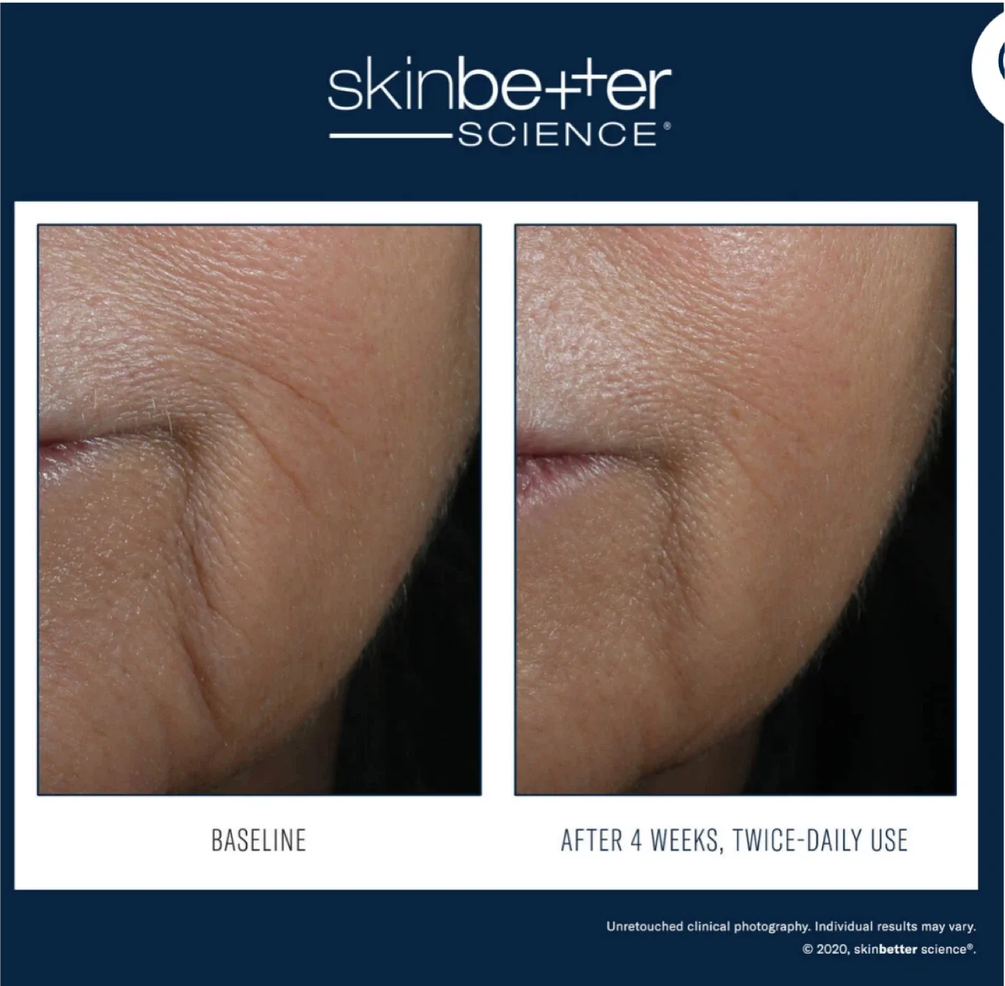 SkinBetter Science InterFuse Intensive Treatment LINES image indicator(3)