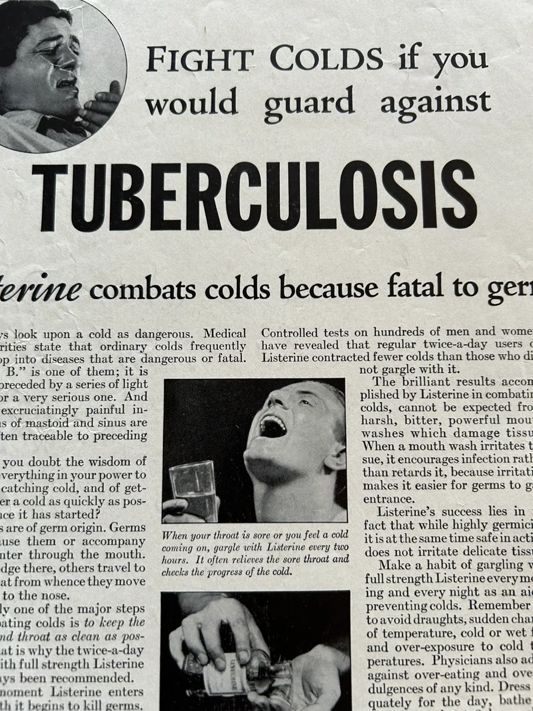 $15  1933 Listerine Rub Fights Colds cause Tuberculosis Print Ad image indicator(3)