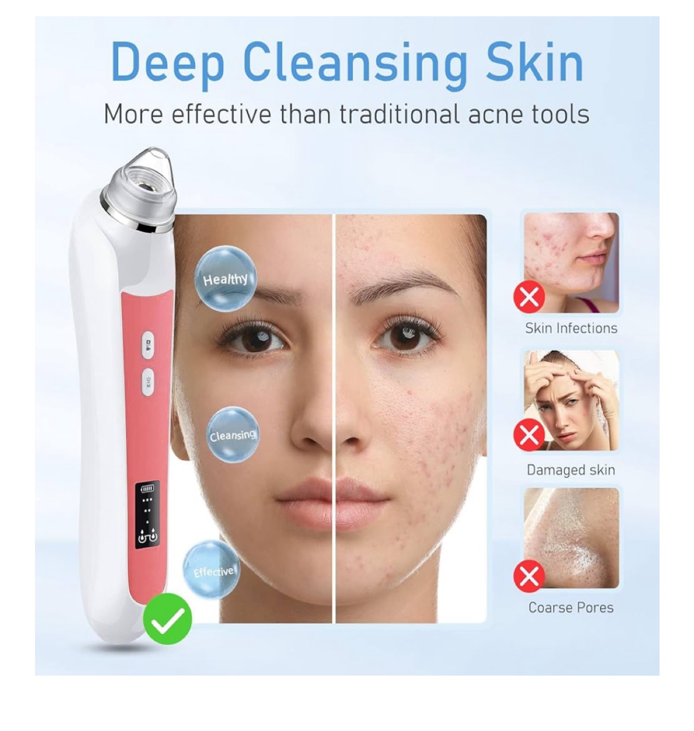 Vacuum Blackhead Remover w/ Built-in HD Camera - New! - photo 5
