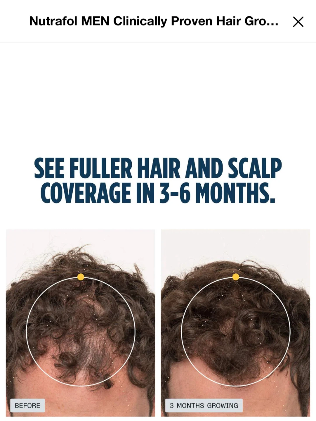 Nutrafol MEN Hair Growth Nutraceutical - photo 2
