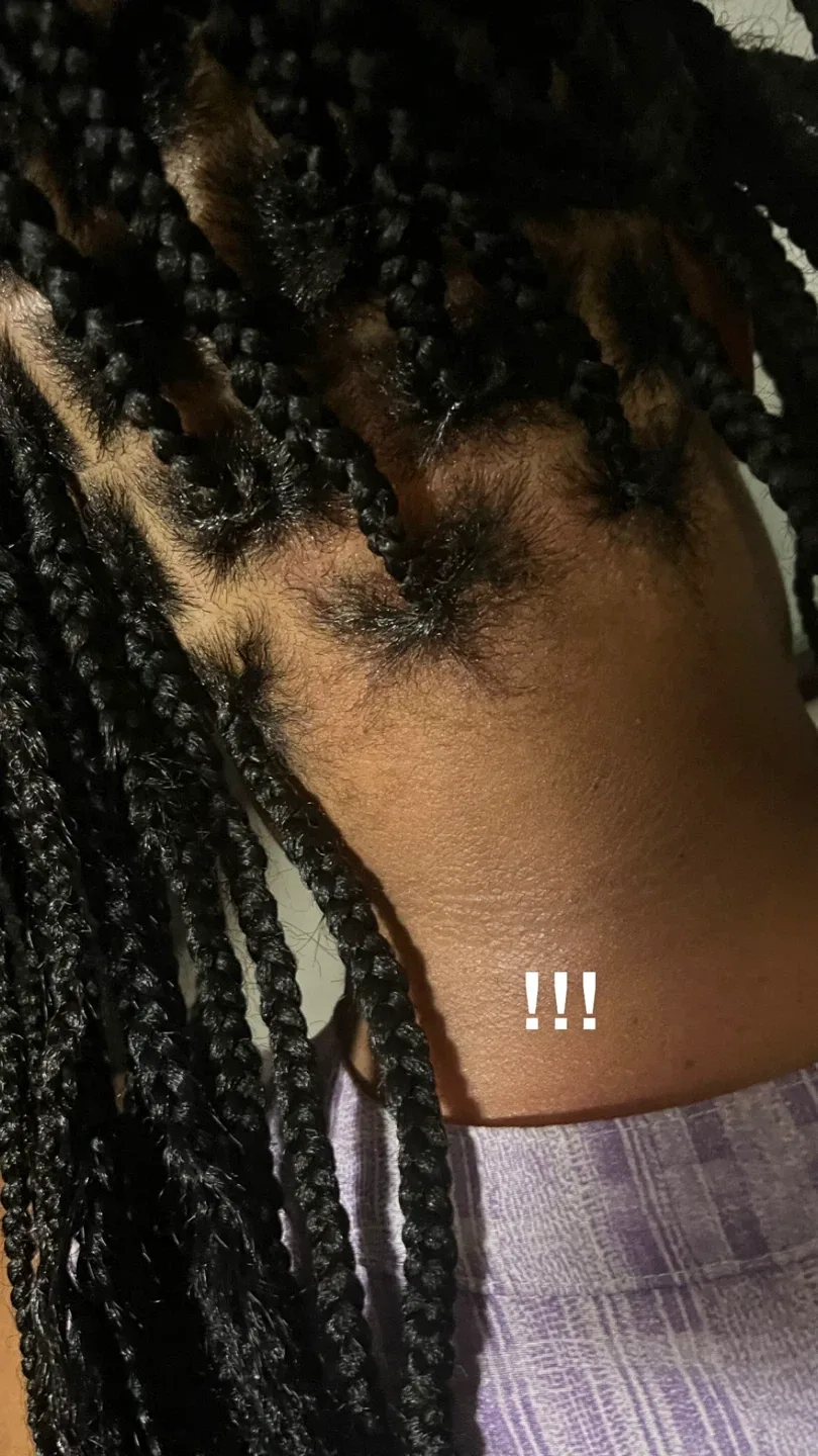 Braids image indicator(9)