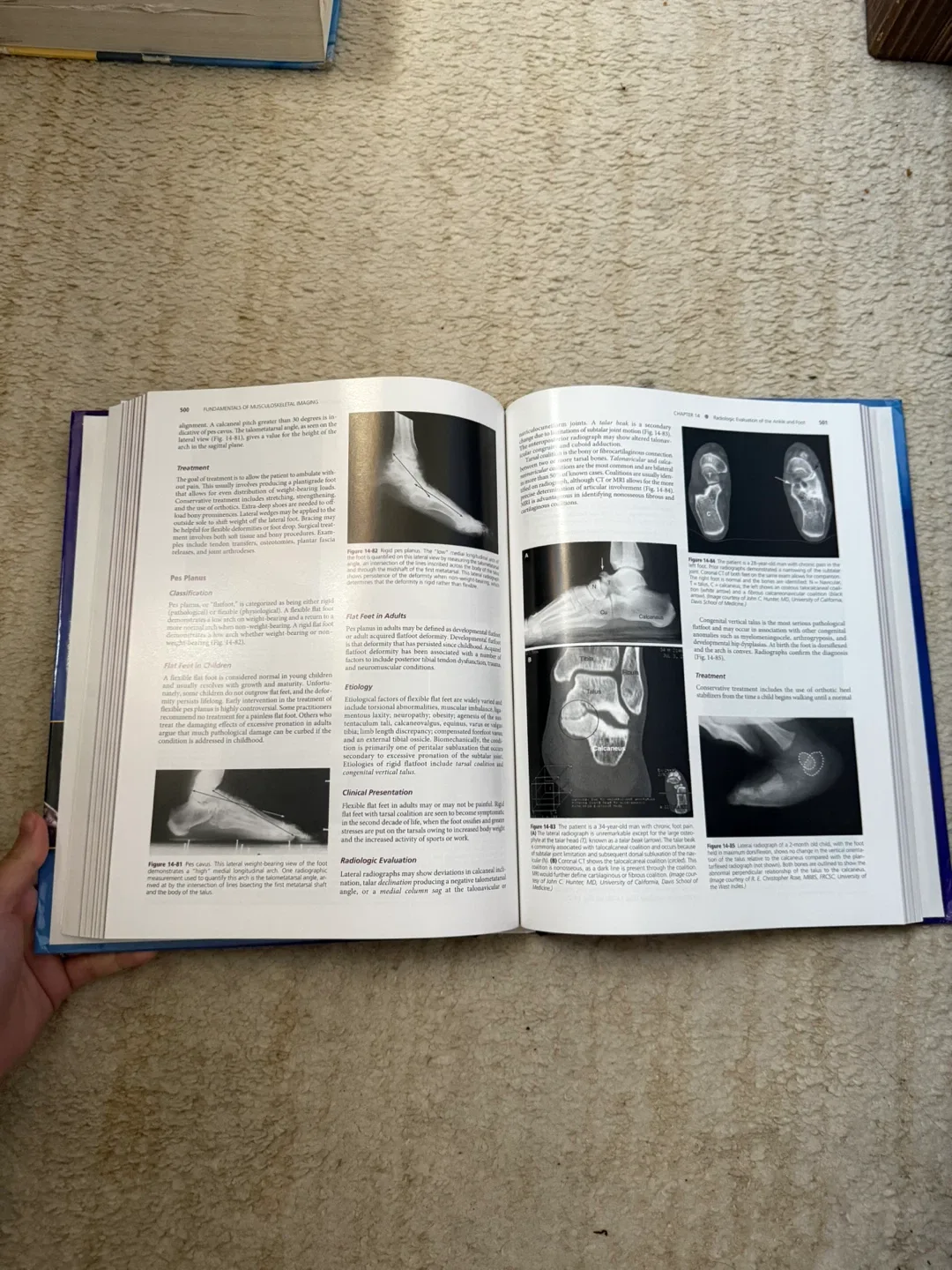 Fundamentals of Musculoskeletal Imaging image indicator(2)