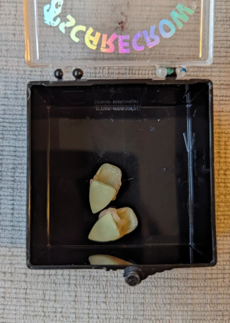 Scarecrow Custom Fangs - Glow in the Dark image indicator(2)